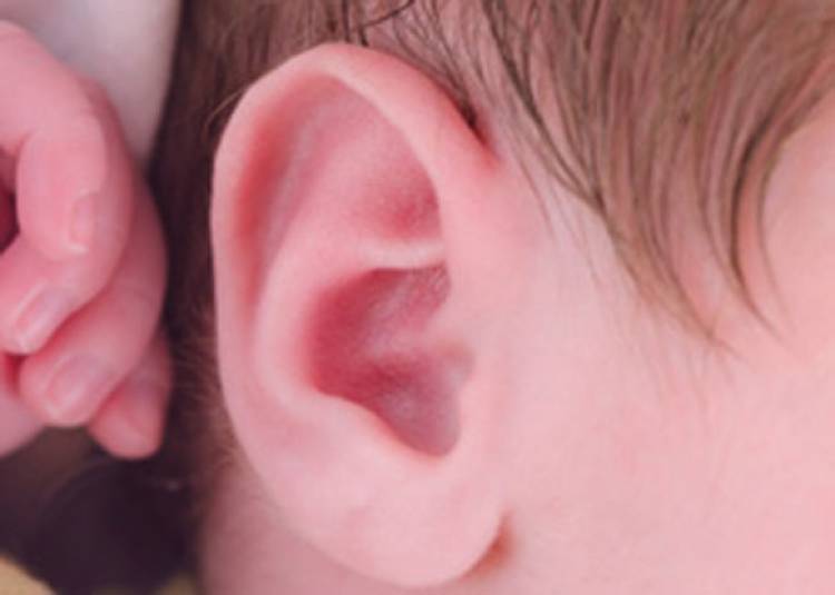 डॉक्‍टरों का कमाल: आठ महीने के बच्चे को दी सुनने की क्षमता