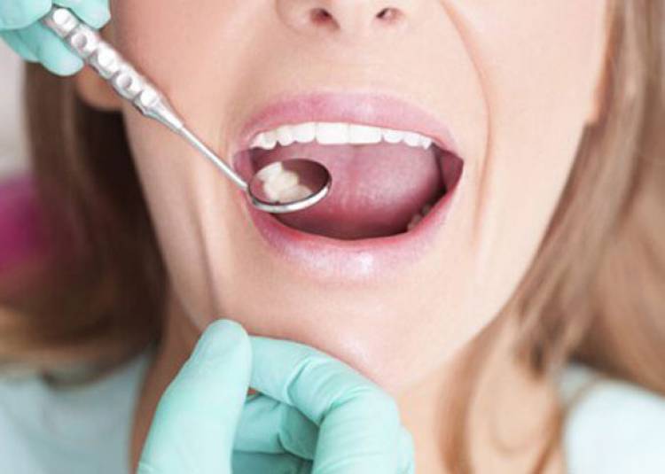 दांतों के खराब होने के लिए आपका जीन हो सकता है जिम्मेदार