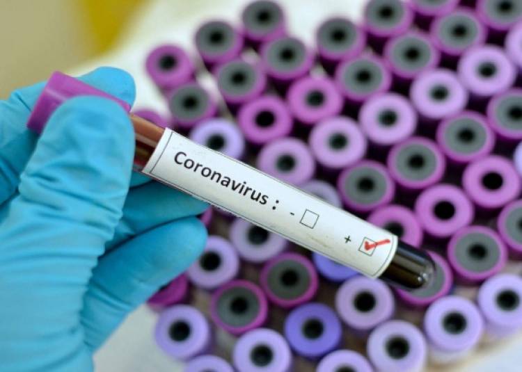 कोरोना वायरस की बन रही है दवा, जापान की इस कंपनी ने शुरु किया कार्य