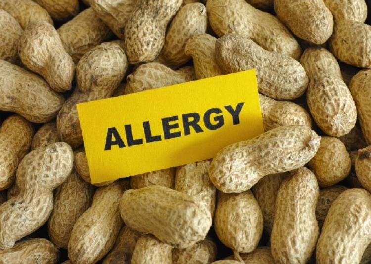 अगर मूंगफली खाते ही बच्चों में दिखें ये 7 लक्षण, तो हो सकती है पीनट एलेर्जी