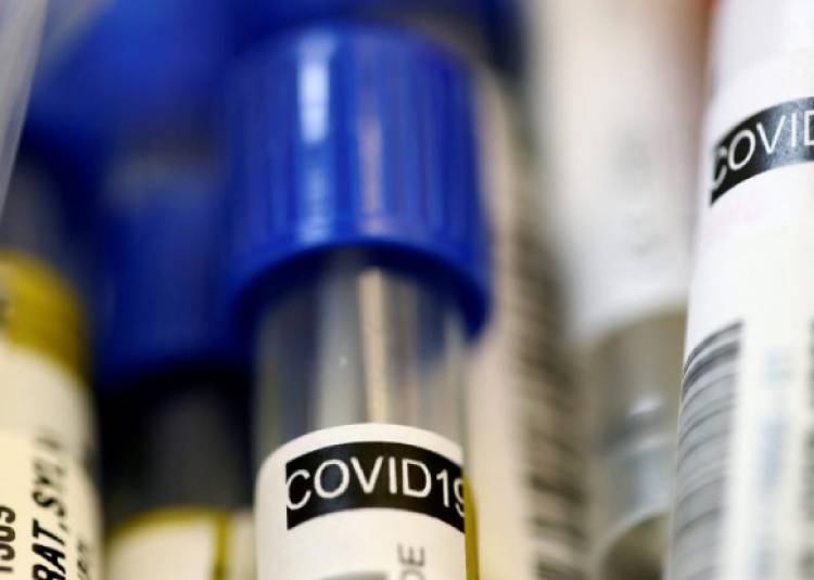 COVID-19 की दवा और 'फर्स्ट मेड इन इंडिया' टेस्टिंग किट के लिए हो जाएं तैयार