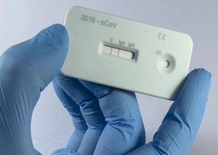 ICMR ने कोरोना वायरस टेस्ट के लिए बनाया एंटी-बॉडी किट, जानिए किन लोगों की होगी जांच
