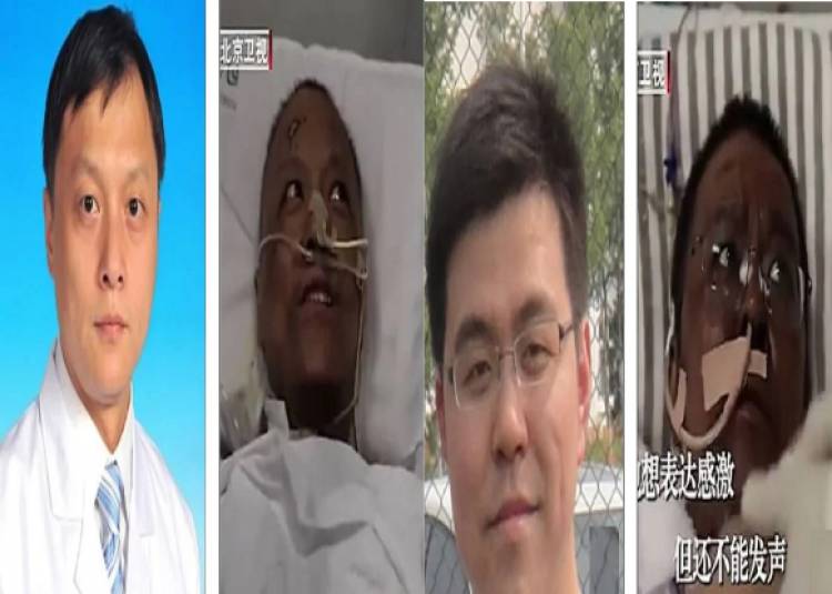 Corona Virus: चीन में दो डॉक्टर के संक्रमित होने पर दिखा अजीब लक्षण