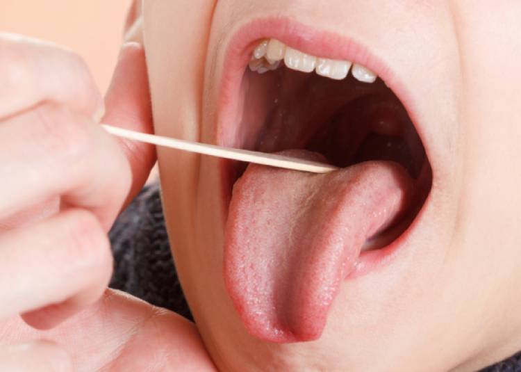 अक्सर मुंह के अंदर पड़ जाते हैं मोटे और सफेद धब्बे, जानें कारण और घरेलू उपचार