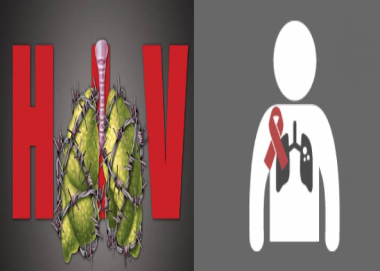 वक्त पर जांच और इलाज से बच सकती है एचआईवी पॉजिटिव-टीबी मरीजों की जान